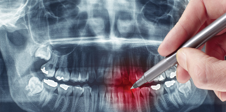portas-para-a-vida+centro-odontologico-londrinense