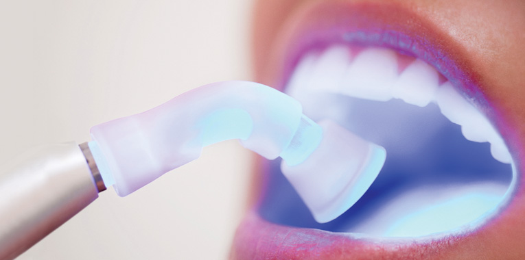 dentistica-restauradora+fabricio-stevan