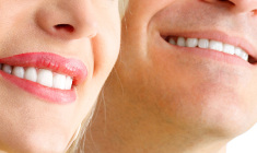 lentes-de-contato-dental+odontologia-estetica+adriane-paglia_