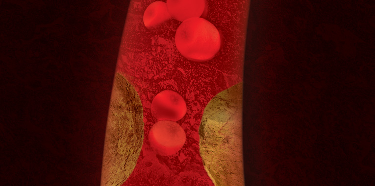 desobstruir-arterias-ficou-mais-facil+alexander-corvello